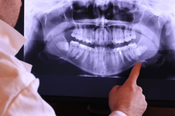 Best Emergency Cosmetic Dentistry (e.g., broken veneers) in Flushing, MI